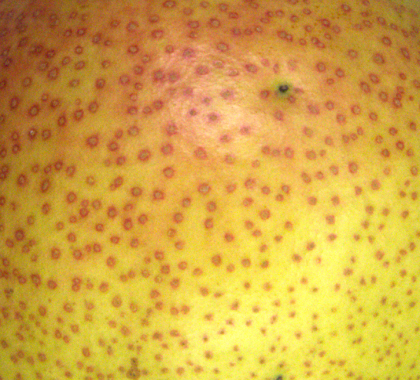 Schalenpunkte rot umhöft.